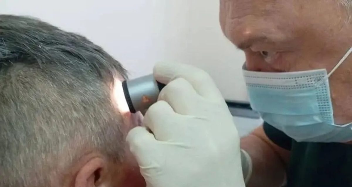 Жители Забайкалья могут бесплатно отправить фото родинки врачу в мессенджере